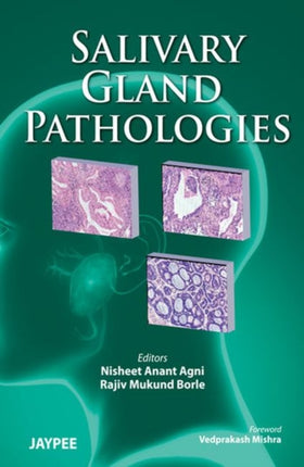 Salivary Gland Pathologies