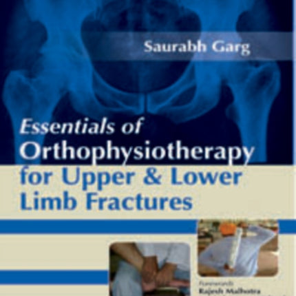 Essentials of Orthophysiotherapy for Upper and Lower Limb Fractures