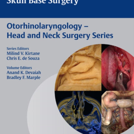 Rhinology and Endoscopic Skull Base Surgery