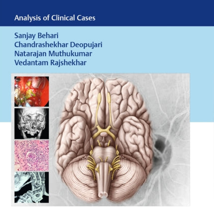 Practical Neurosurgery