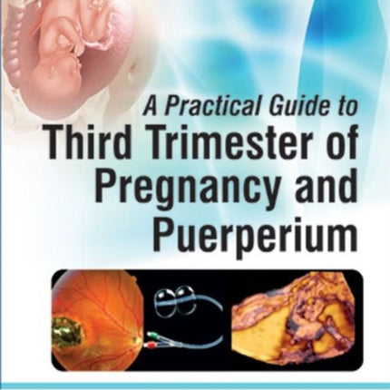 A Practical Guide to Third Trimester of Pregnancy & Puerperium