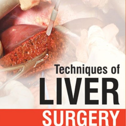 Techniques of Liver Surgery