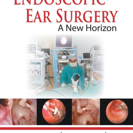 Endoscopic Ear Surgery: A New Horizon