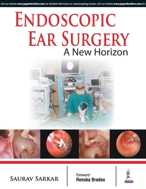 Endoscopic Ear Surgery: A New Horizon