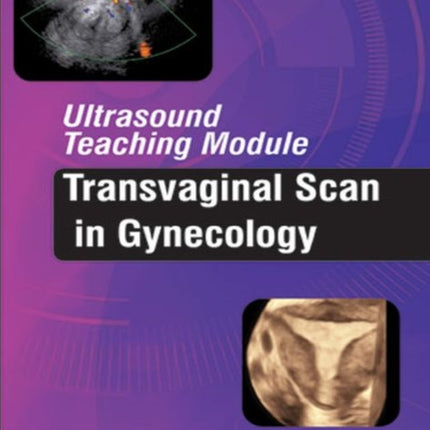Ultrasound Teaching Module: Transvaginal Scan in
