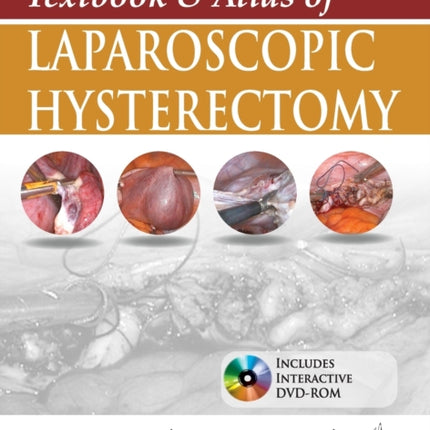 Textbook & Atlas of Laparoscopic Hysterectomy