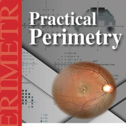 Practical Perimetry
