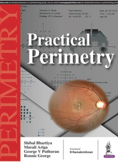 Practical Perimetry
