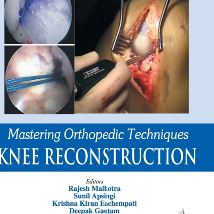 Mastering Orthopedic Techniques: Knee Reconstruction