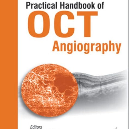 Practical Handbook of OCT Angiography