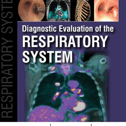 Diagnostic Evaluation of the Respiratory System