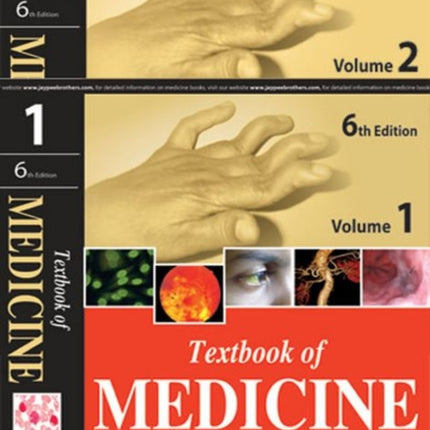 Textbook of Medicine: Two Volume Set