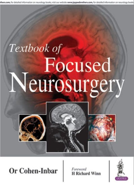 Textbook of Focused Neurosurgery