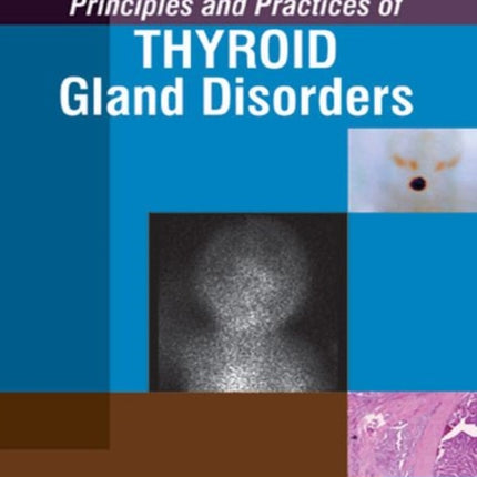 Principles and Practices of Thyroid Gland Disorders