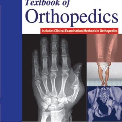 Textbook of Orthopedics