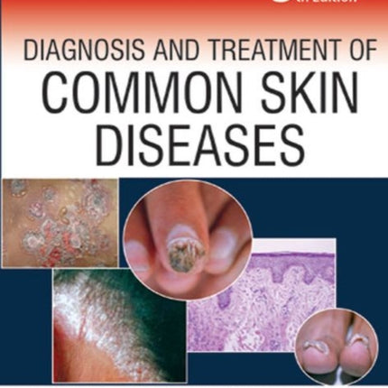 Diagnosis and Treatment of Common Skin Diseases