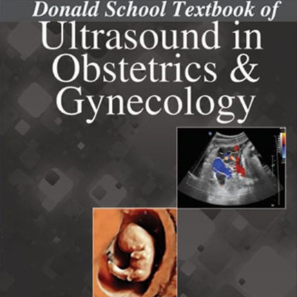 Donald School Textbook of Ultrasound in Obstetrics & Gynaecology