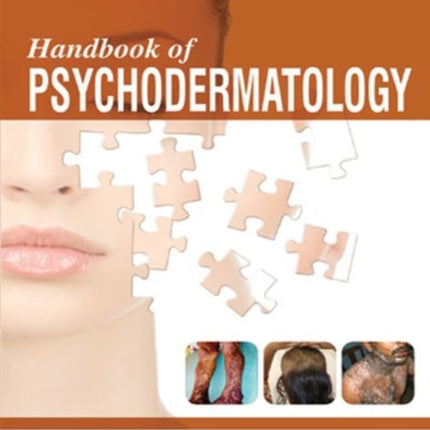 Handbook of Psychodermatology