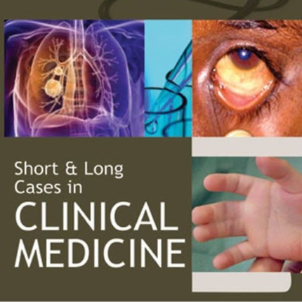 Short and Long Cases in Clinical Medicine