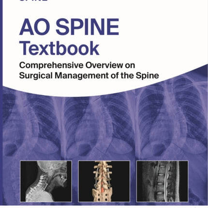 AO Spine Textbook: Comprehensive Overview on