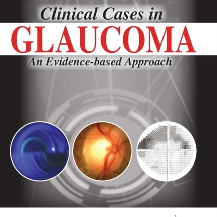 Clinical Cases in Glaucoma: An Evidence Based Approach