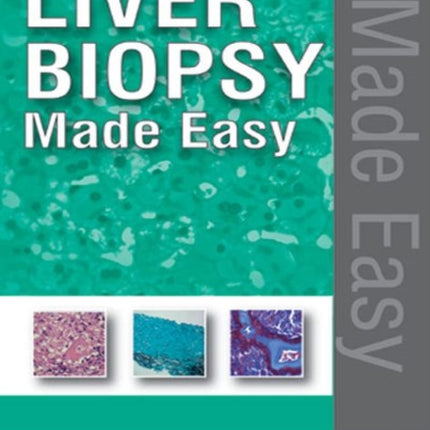 Liver Biopsy Made Easy