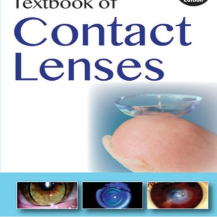 Textbook of Contact Lenses