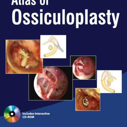 Atlas of Ossiculoplasty