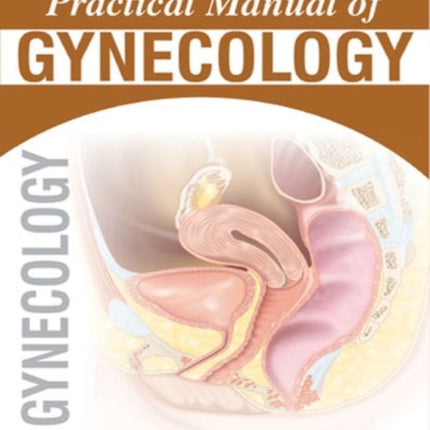 Practical Manual of Gynecology