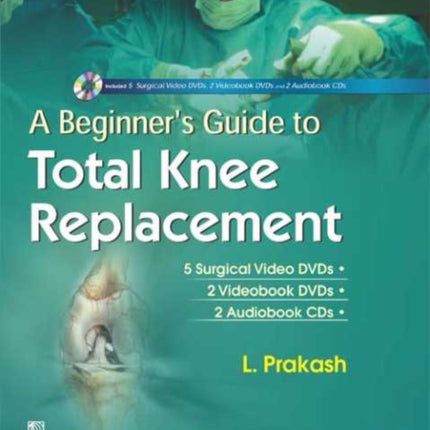 A Beginner's Guide to Total Knee Replacement