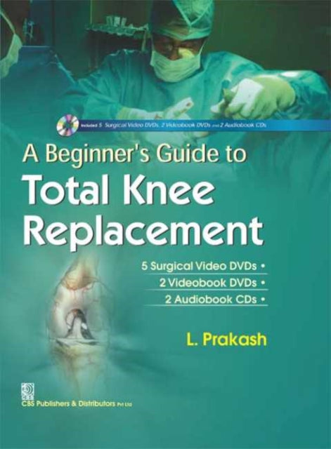 A Beginner's Guide to Total Knee Replacement