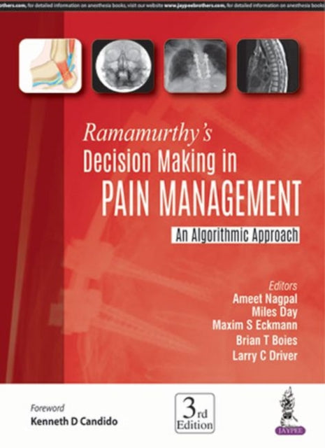 Ramamurthy's Decision Making in Pain Management: