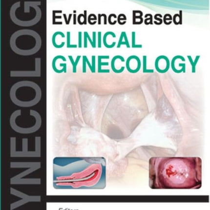 Evidence Based Clinical Gynecology