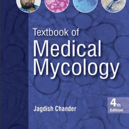 Textbook of Medical Mycology