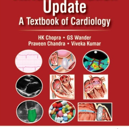 Atrial Fibrillation Update: A Textbook of Cardiology