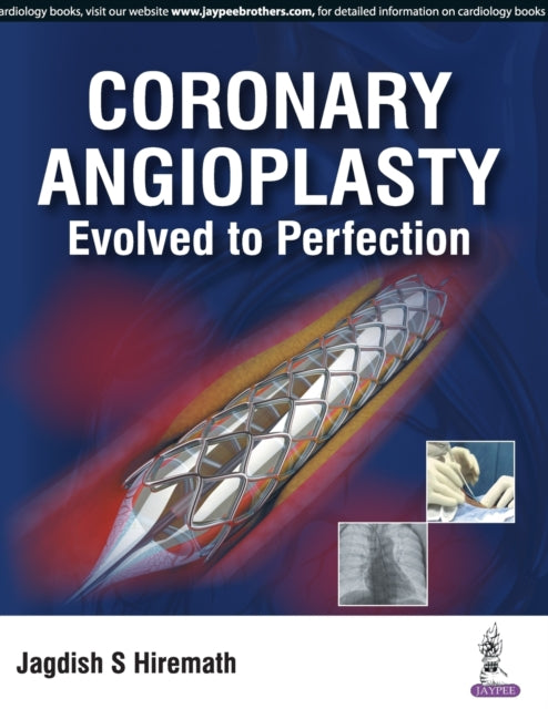 Coronary Angioplasty: Evolved to Perfection