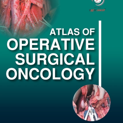 Atlas of Operative Surgical Oncology