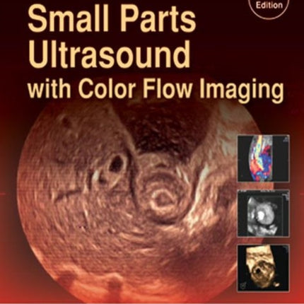 Atlas of Small Parts Ultrasound: with Color Flow Imaging