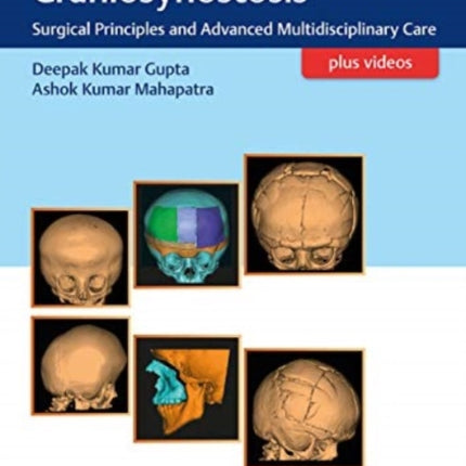 Tenets of Craniosynostosis: Surgical Principles and Advanced Multidisciplinary Care