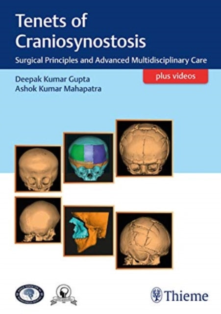Tenets of Craniosynostosis: Surgical Principles and Advanced Multidisciplinary Care