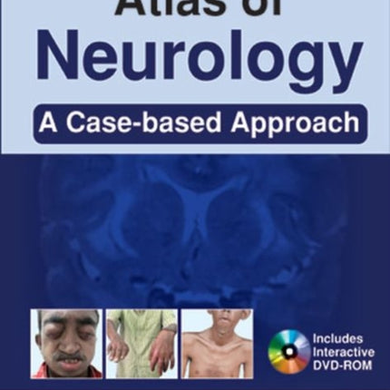 Atlas of Clinical Neurology