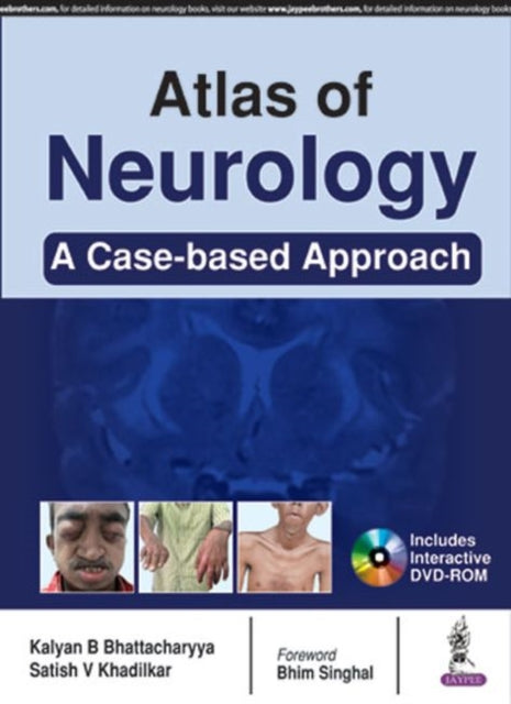 Atlas of Clinical Neurology