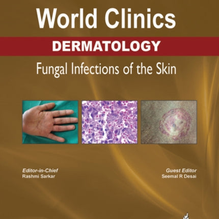 World Clinics Dermatology: Fungal Infections of the Skin: Volume 3, Number 1