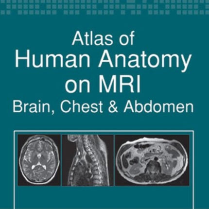 Atlas of Human Anatomy on MRI: Brain, Chest & Abdomen