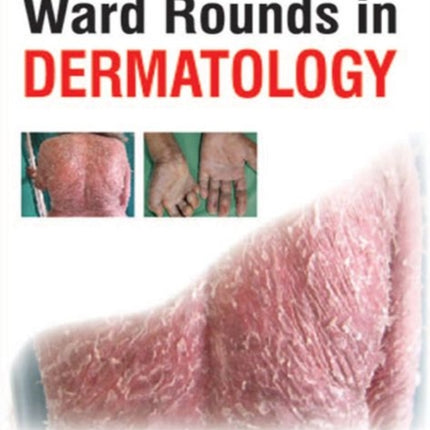 Ward Rounds in Dermatology