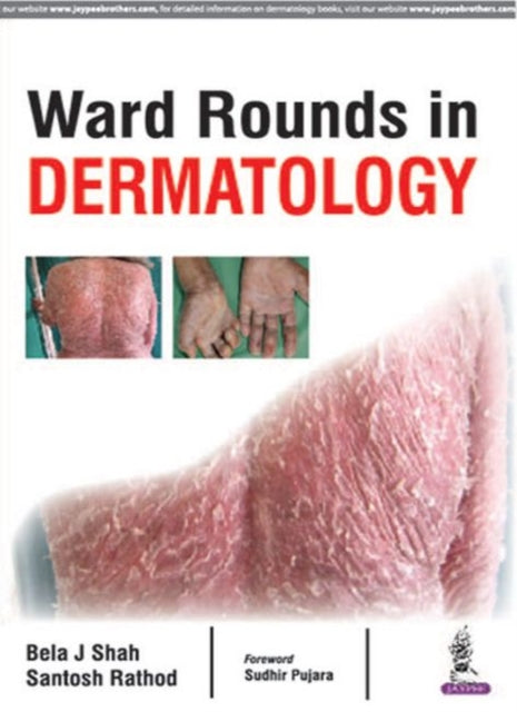 Ward Rounds in Dermatology