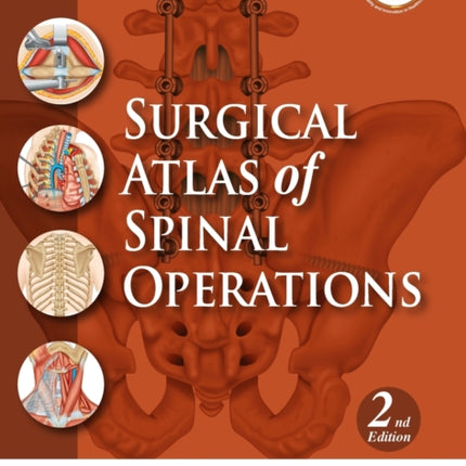 Surgical Atlas of Spinal Operations