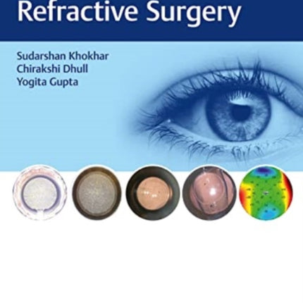 The Art of Refractive Surgery