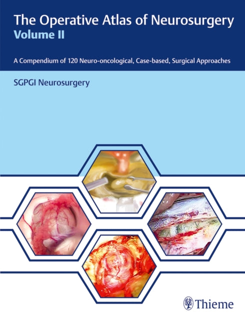 The Operative Atlas of Neurosurgery, Vol II: A Compendium of 120 Neuro-oncological, Case-based, Surgical Approaches