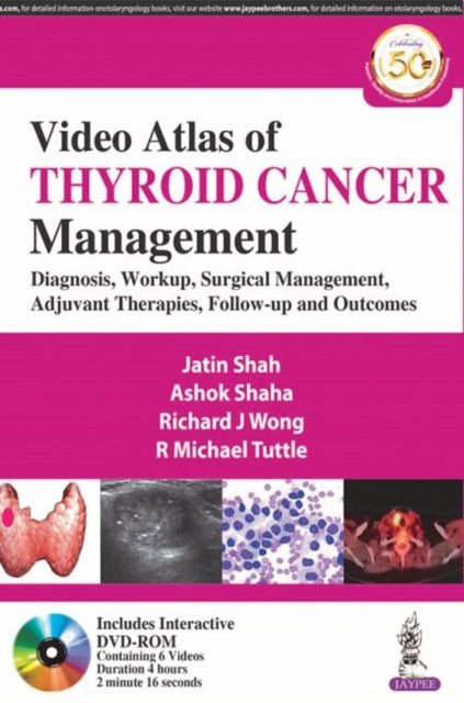 Video Atlas of Thyroid Cancer Management: Diagnosis, Workup, Surgical Management, Adjuvant Therapies, Follow-up and Outcomes